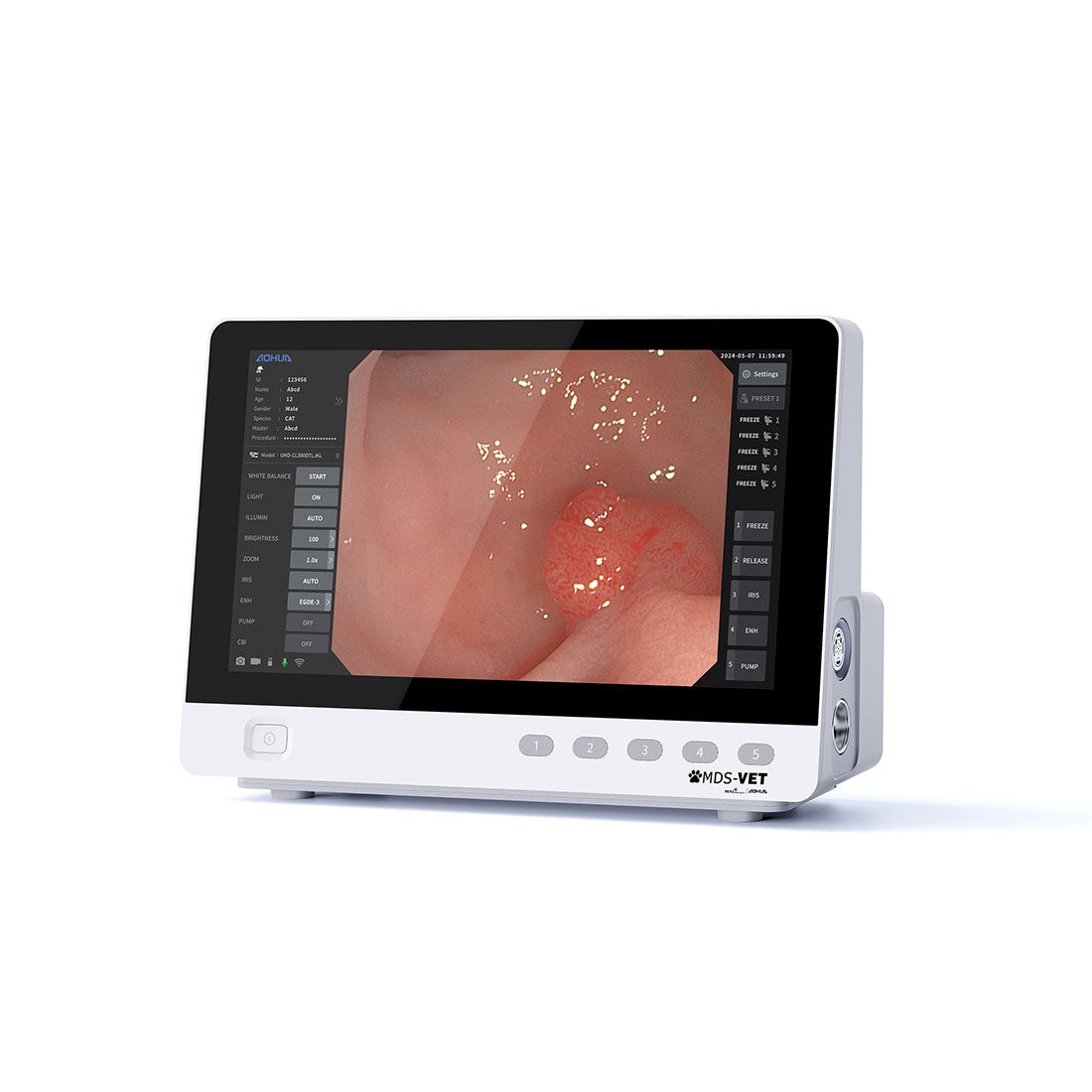 Portable All-in-One Endoscopy System, Touch screen (OR-160)