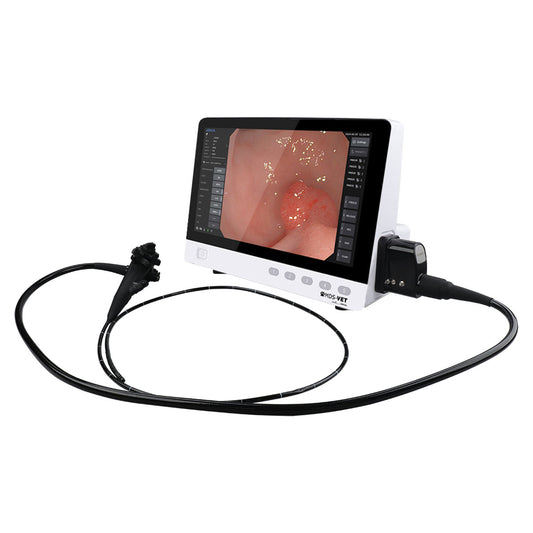 HD Video Endoscope System (with OR-160), 6 mm Dia. x 150 cm Length, 2.8 mm Working Channel